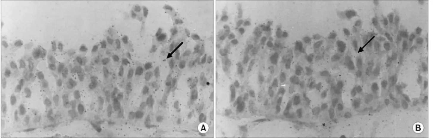Fig. 3. The expressions of the GnRH (A, C) and GnRH receptor (B, D) proteins in human normal bladder mucosa tissue (A, B) and primary cultured dog bladder mucosal epithelia (C, D)