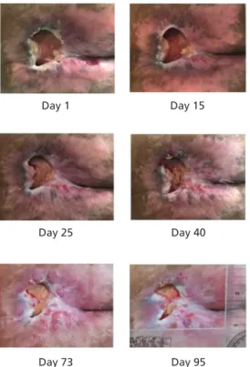 Fig. 3.  Pressure ulcer surface area