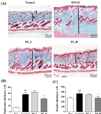 Figure 2. The effects of PS on epidermis and dermis thickness  in DNCB-induced BALB/c mice.
