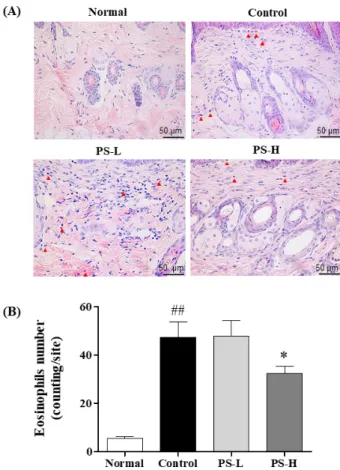 Figure  4.  The  effect  of  PS  on  mast  cell  infiltration  in  DNCB-  induced BALB/c mice.