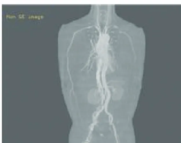 Fig. 1.  Upper extremity angio CT (11.22)