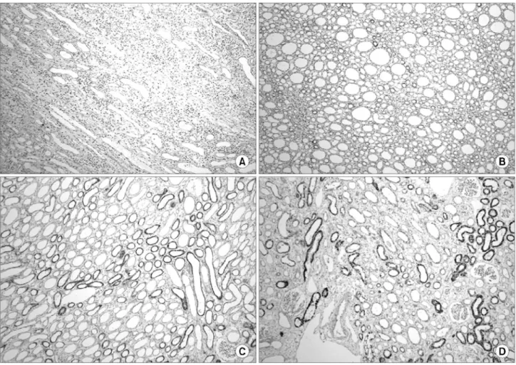 Fig. 2. Classification of immunohistochemical staining for vascular endothelial growth factor