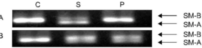 Fig. 3. Two representative reverse transcriptase-polymerase chain reaction (RT-PCR) amplifications for the SM-A and SM-B  expres-sion in the rat urinary bladders of the control (C), the spinal cord injured group (S), and the partial obstruction group (P).
