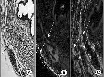 Fig.  6.  Histology  of  the  MDSC/chitosan/hydroapatite  injected  urethral  sphincter  of  female  rat