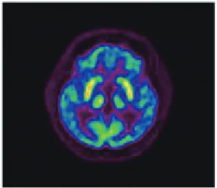 Fig. 1. PET-CT