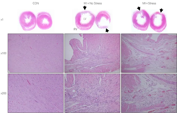 Fig.  1.  Microscopic  features  of  heart  ventricle  in  each  group.  Arrows  indicate  the  infarction  area  (×1)