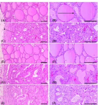 Fig. 4. Representative histopathological profiles of the left thyroid  glands in the intact control(A, B), PTU control(C, D), LT 4 (E, F), AR  extracts 300(G, H) and 150(I, J) mg/kg treated rats.