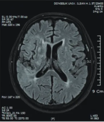 Fig. 1. Magnetic Resonance Imaging(2015-04-22)