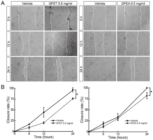 Fig  4.  Effects  of  GFET  and  GFEA  on  mRNA  expression  of  tight  junction  related  genes