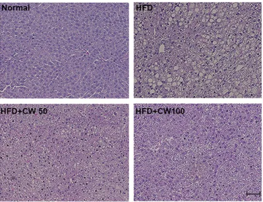 Fig. 4. Effect of CW extracts on blood lipid parameters in HFD-induced obese. 