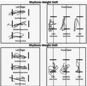Fig. 2. Balance master Ⓡ  system 
