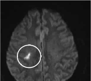 Figure 1. Brain MRI-1