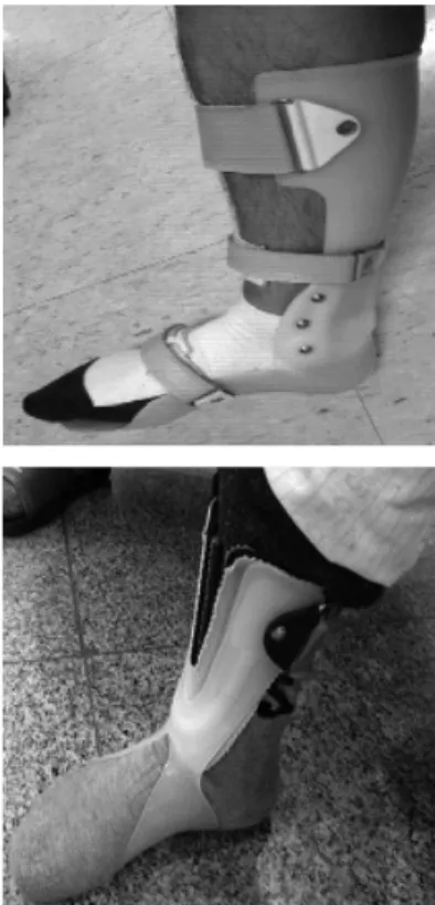Fig. 2. Ankle foot orthosis(AFO) type for case 1(top)  and 2(bottom) with foot drop.