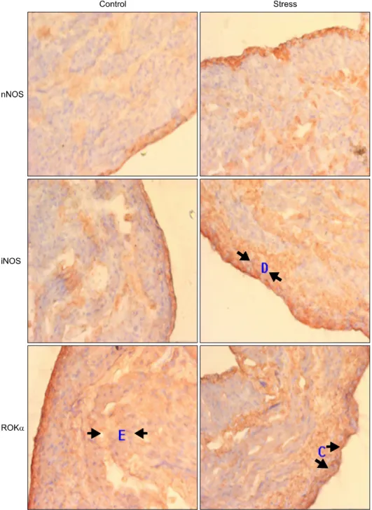 Fig.  2.  Pattern  of  the  DAB  positive  area  in  bladder  tisssue  after   im-munohistochemical  staining  for  nNOS,  iNOS  and  ROKα  at  20  days