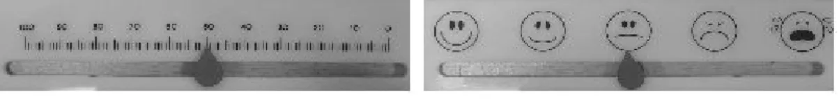Fig. 1 Visual Analogue  Scale  Ruler 능이 저하된 세포의 activity를 높이게 된다고  하였다. 임상적용에 있어서 김  등 12) 은 안면  부위를 지 배하는 신경에 파장 904nm, 평균출력 40mW의  Ga-Al-As(IR) 레이저를 조사하여 삼차신경통 의 통증조절에 효과가 있음을 보고하였고, 문 9) 의  연구에서는 남성형 탈모증의 저출력  레이저  치료가 모발의 개수와 생장기/휴지기 모발의  비율을  증가시키는 효과