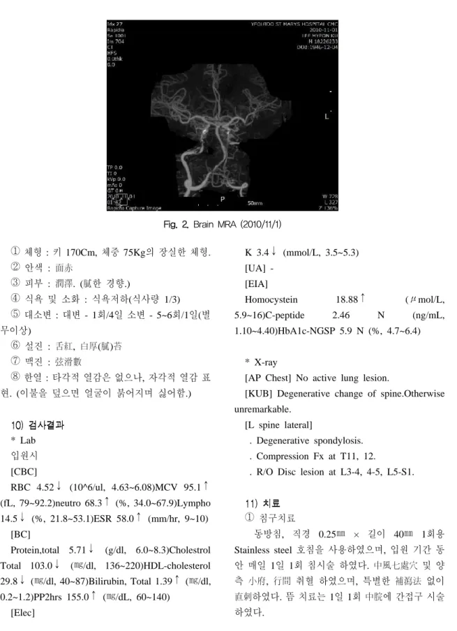 Fig.  2.  Brain  MRA  (2010/11/1)
