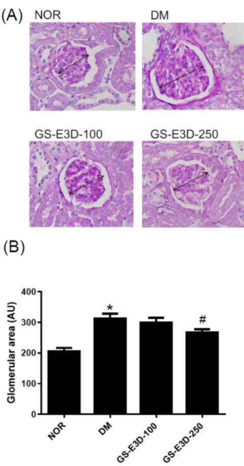 Figure 2. Renal histopathology. (A) Periodic acid-Schiff staining  of  glomeruli.  Arrows  indicate  glomeruli  of  various  sizes