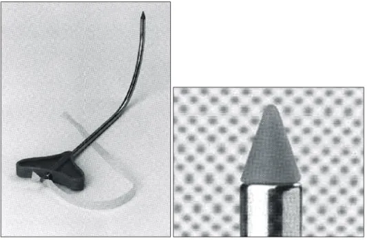 Fig.  2.  The  tape  is  inserted  through  the  levator  muscle  complex  and  it  is  attached  at  only  the  insertion  points  of  the  uterosacral  ligament  into  the  vagina