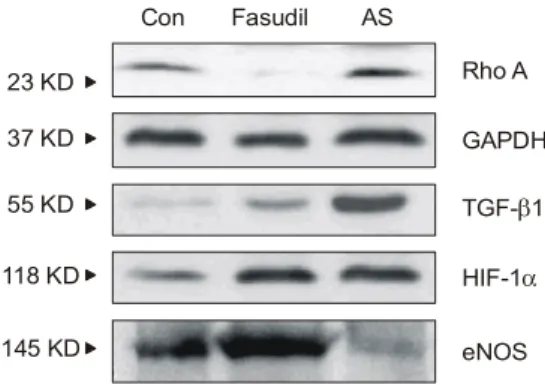 Fig.  5.  The  protein  expression  of  our  experimental  groups  is  analysed  by  Western  blotting