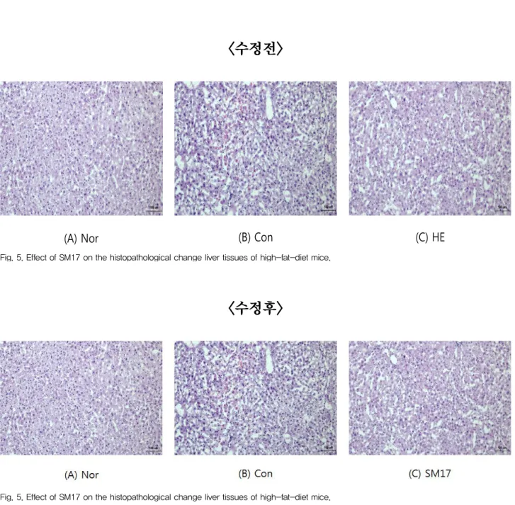 Fig. 5. Effect of SM17 on the histopathological change liver tissues of high-fat-diet mice.
