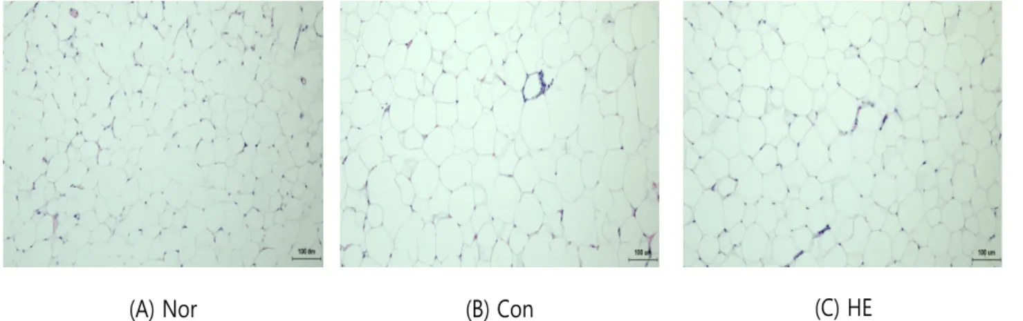 Fig. 6. Effect of SM17 on the histopathological change epididymis fat tissues of high-fat-diet mice.