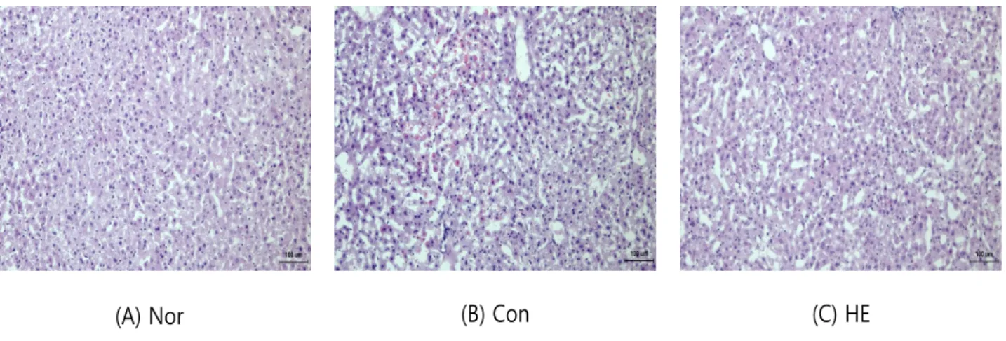 Fig. 5. Effect of SM17 on the histopathological change liver tissues of high-fat-diet mice.