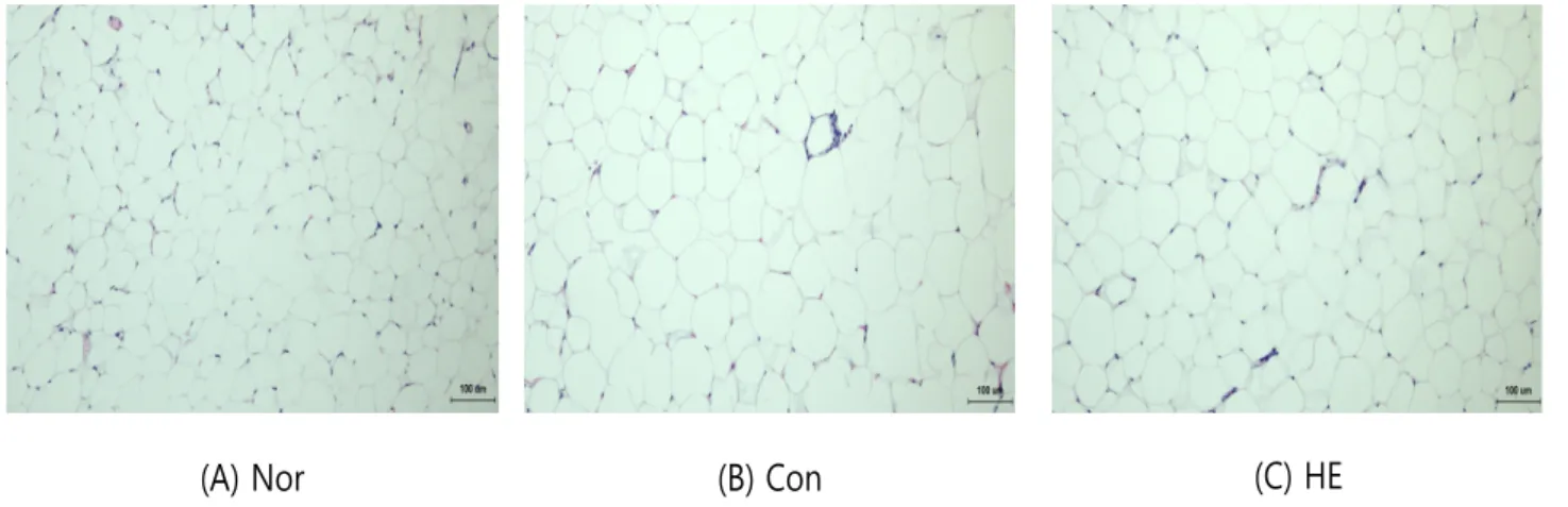 Fig. 6. Effect of SM17 on the histopathological change epididymis fat tissues of high-fat-diet mice.