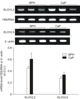 Fig.  2.  Representative  examples (upper  panel)  and  densitometric  analyses (lower  panel)  of  the  polymerase  chain  reaction (PCR)  products  for  fatty  acid  elongase (ELOVL)  2  and  ELOVL5,   cor-rected  for  18S  rRNA  or  β-actin,  respective