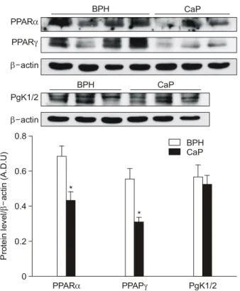 Fig.  4.  Expressions  of  peroxisome  proliferator-activated  receptor  (PPAR)α,  PPARγ  and  phosphoglycerate  kinase  1 (PgK1),   cor-rected  for  β-actin,  in  each  sample