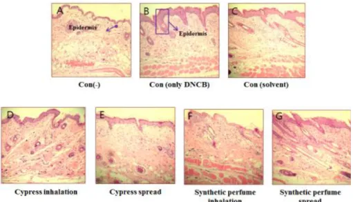 Fig. 3. Protective Effects of Cypress oil on the DNCB-induced Atopic Dermatitis in NC/Nga Mice-Histological Evaluation (H&amp;E Staining)