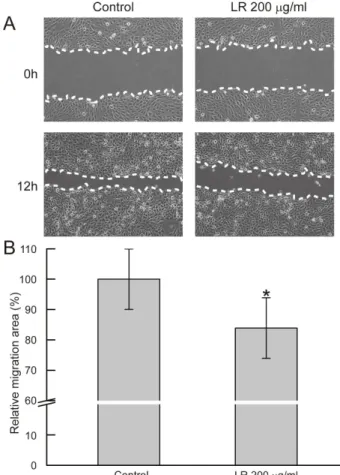 Fig 4. Reduction by Lithospermi Radix 200 ㎍/㎖ of HaCaT cells  migration.  (A)  Representative  images  of  wound  healing  assay