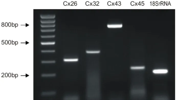 Fig.  4.  Ethidium  bromide-stained  gel  of  the  polymerase  chain  reac- reac-tion  (PCR)  products  for  connexin (Cx)26,  Cx32,  Cx43  and  Cx45  in  human  bladder  mucosae.