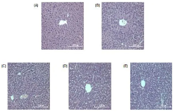 Fig 8. Effect of 0HF0, 0HF2, 0HF3 on the histopathological change liver-tissues of LPS treated mice.