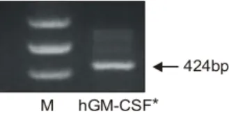 Fig.  2.  Time  course  of  the  IL-6mRNA  expression  in  PC-3  cells. 