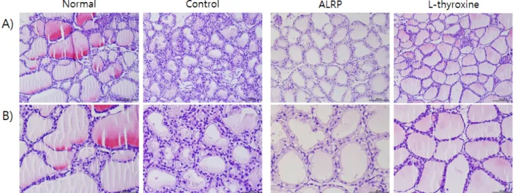Fig. 6. Effects of ALRP extract on the histological changes of thyroid tissues in PTU-induced hypothyroidism rats