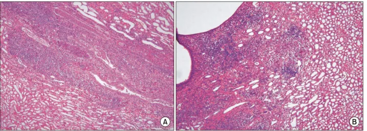 Fig.  3.  Light  microscopic  findings  of  the  renal  prenchyma  4  weeks  after  infection