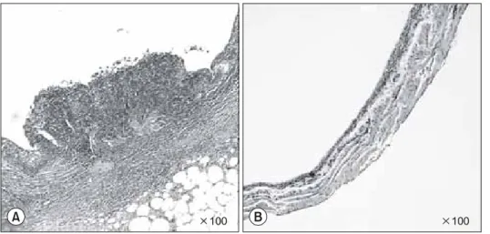 Fig.  1.  Histological  aspects  of  blad- blad-ders  from  mice  on  day  21  after  intravesical  instillation  therapy (A)