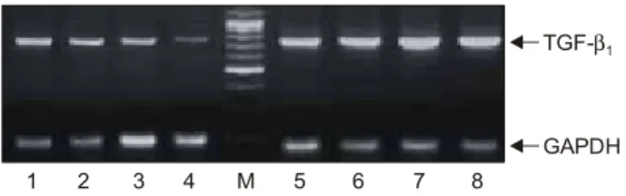 Fig.  3.  Expression  of  TGF-β 1   mRNA  is  increased  in  the  5ARI  compared  to  the  control  group (M:  marker,  1-4:  control  group,  5-8: 