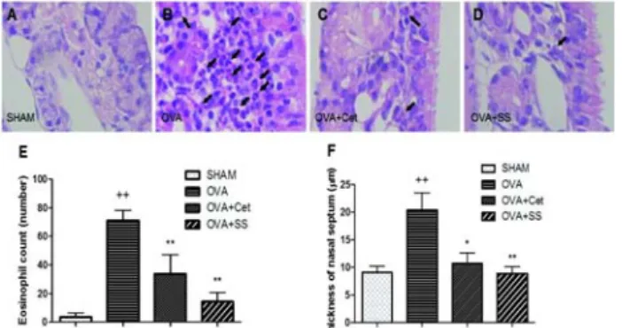 Fig.  2.  The  effect  of  SS  extract  on  the  nasal  rubbing  and  sneezing  symptom  in  OVA-induced  allergic  rhinitis  mice.