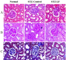 Fig.  6.  The  Effect  of  LF  extract  on  the  histopathological  change  of  kidney  in  streptozotocin-induced  diabetic  rats
