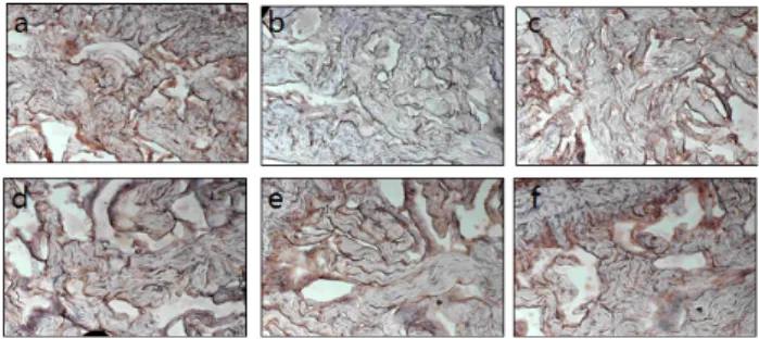 Fig.  4.  Immunohistochemical  expression  of  endothelial  nitric  oxide  synthase  (eNOS)  in  cavernosal  tissue