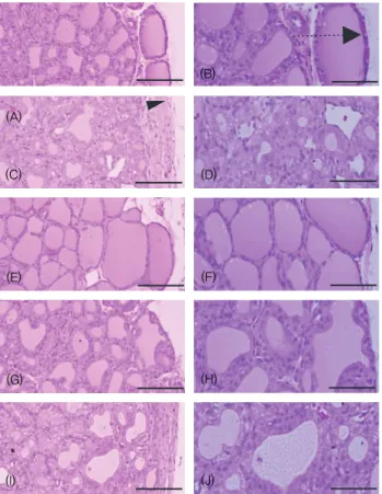 Fig.  5.  Representative  histopathological  profiles  of  the  left  thyroid  glands  in  the  intact  control  (A,  B),  PTU  control  (C,  D),  LT 4   (E,  F),  MF  extracts  300  (G,  H)  and  150  (I,  J)  mg/kg  treated  rats