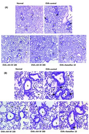 Fig. 9. Effects of Agastachis Herba water extract on the histopathological  changes  in  lung  tissues  of  OVA-induced  asthma  mice