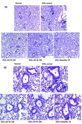 Fig. 9. Effects of Agastachis Herba water extract on the histopathological  changes  in  lung  tissues  of  OVA-induced  asthma  mice