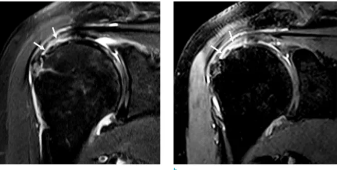 Table 3. Area Under Receiver Operating Characteristics Curve (AUC) of Three Readers in Evaluating Rotator Cuff Tears