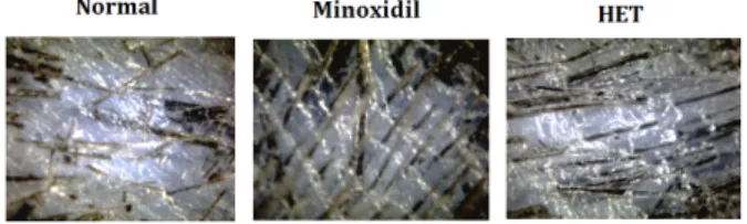 Fig.  1.  Effect  of  HET  on  hair  density  and  hair  thickness  in  alopecia  model  of  C57BL/6  mice  by  Folliscope