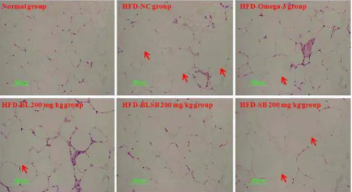 Fig.  4.  Effect  of  bamboo  leaf,  Scutellaria  baicalensis   and  their  combination  extracts  on  histological  profiles  of  epididymal  adipose  tissue  in  HFD-induced  obese  mice
