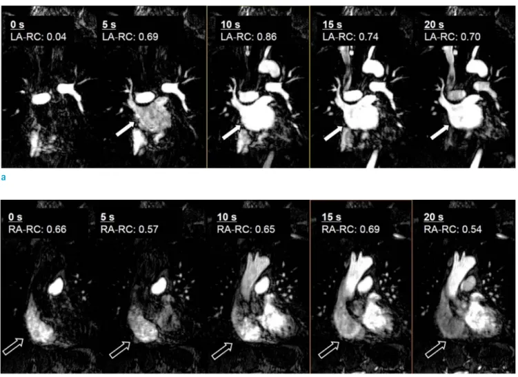 Fig. 1.  Sequential CMR-CENTRA images for the visualization of the contrast media passing through the heart