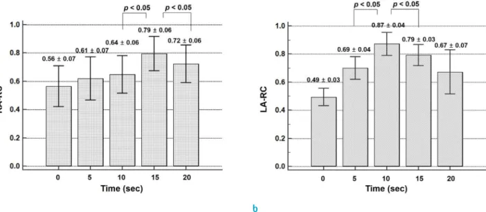 Table 1 summarizes the clinical information of all 50  patients (38 men; mean age, 59.6 ± 9.3 years)