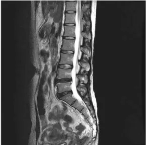 Fig. 1. L-spine MRI sagittal T2-weighted image (2019-05-14).
